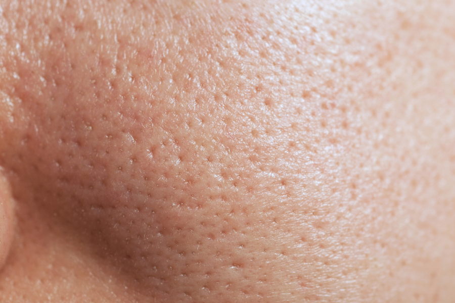 Can You Really Shrink Pores? Here’s the Truth from Nalu Skin & Body!