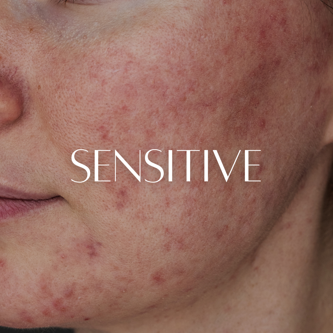 Sensitive Skin