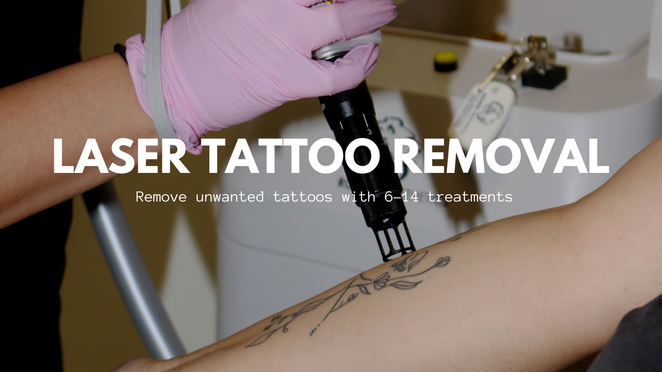 The Ins and Outs of Tattoo Laser Removal - Ink Satire Tattoo Blog